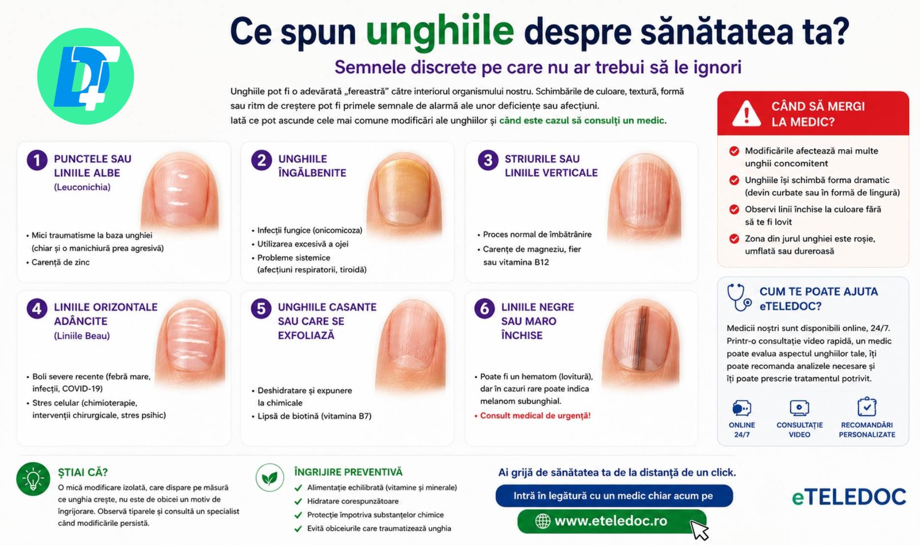 Unghiile pot ascunde semne ale unor carențe sau boli. Află ce înseamnă modificările de culoare, formă și textură.